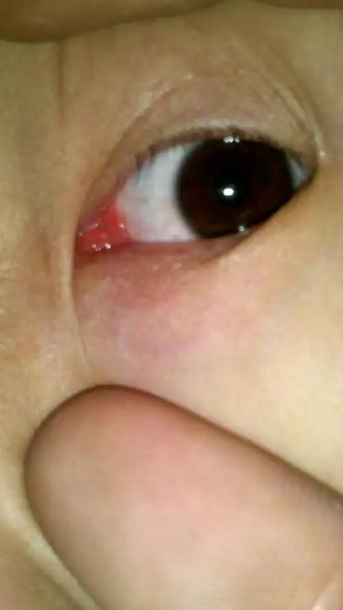 我这眼睛有问题吗?感觉有东西在里面.