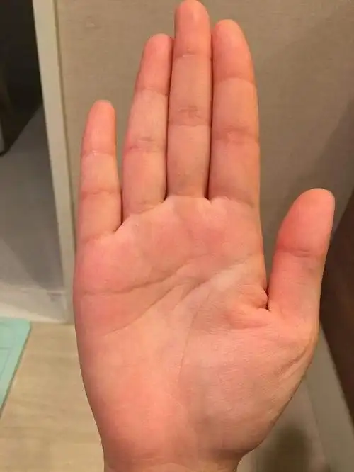 俗话说:"断掌一条线,富贵不相欠",是什么意思?你是断掌吗?