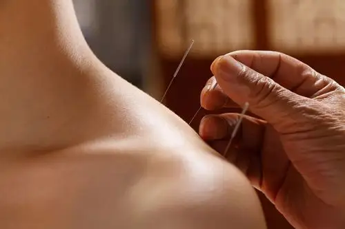 但是中医针灸也具有一定的弊端如:1.