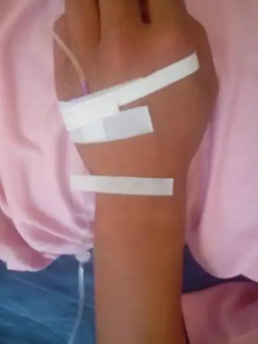 要一张女生手背输液的照片!急