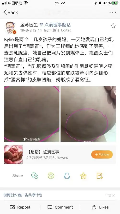 医学博主科普乳腺癌,没想到评论居然