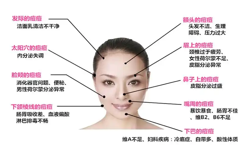 哪些原因会诱发痘痘生长的?