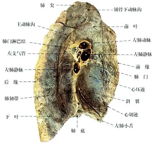 正常肺部解剖示意图-人体解剖图