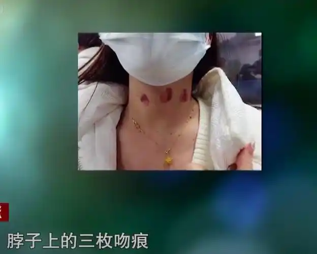 2021年女孩约男网友被下药醒来脖子上三道吻痕竟是女人留下的