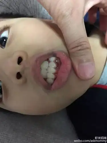 儿科医生妈妈:警惕这样的喷鼻剂!