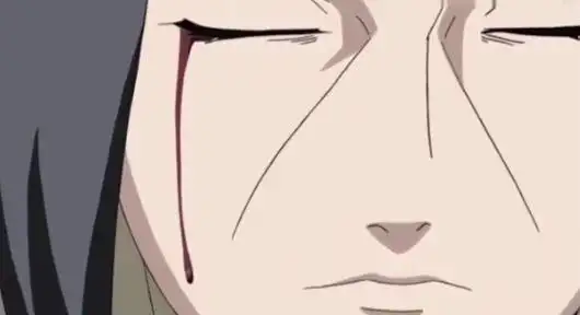 秽土转生中唯一一个会流血的忍者明明是死人为什么眼睛会受伤