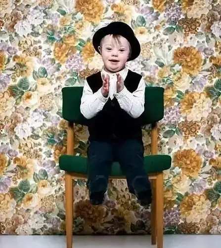 震惊每对夫妻都可能生出唐氏儿