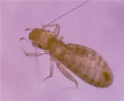 墙上有会爬会跳的小虫子,是什么虫,怎么去除?