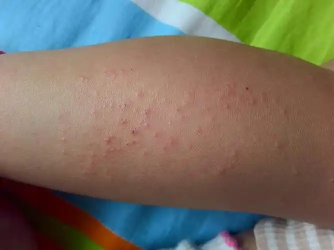 急,求高人指点,非常感谢!