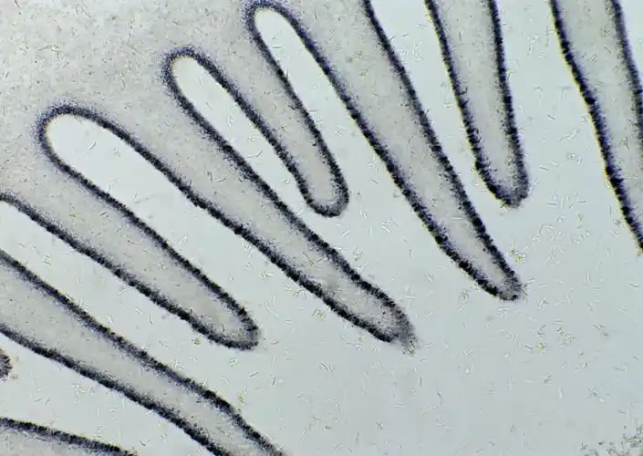 灰色线条细胞体