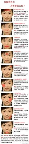 从中医角度可以看出脸上哪里涨痘痘,就是身体哪个位置有问题,有人知道
