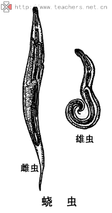 蛲虫是怎么样的?有图片吗?