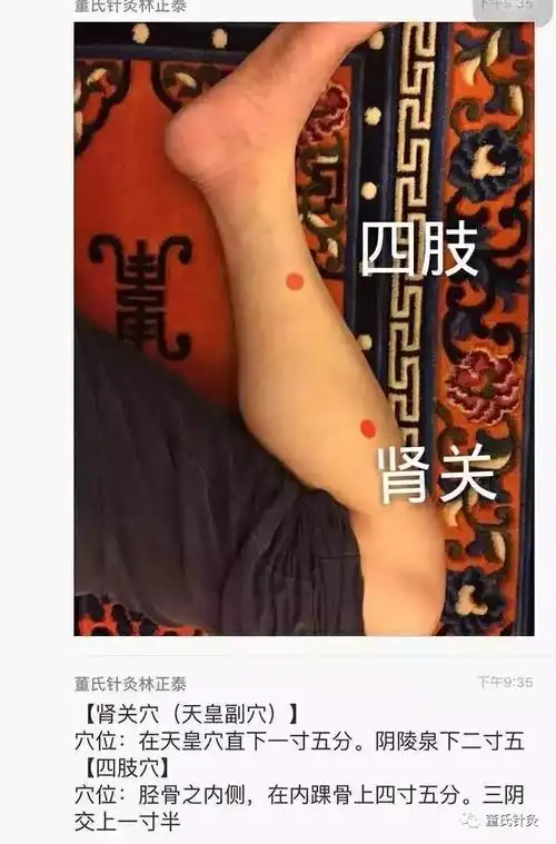 四肢:四肢疼痛都能治 | 董氏针灸 穴位解读肾关:治肾亏 | 董氏针灸