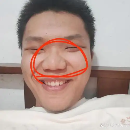 面相 这个是蒜头鼻吗?