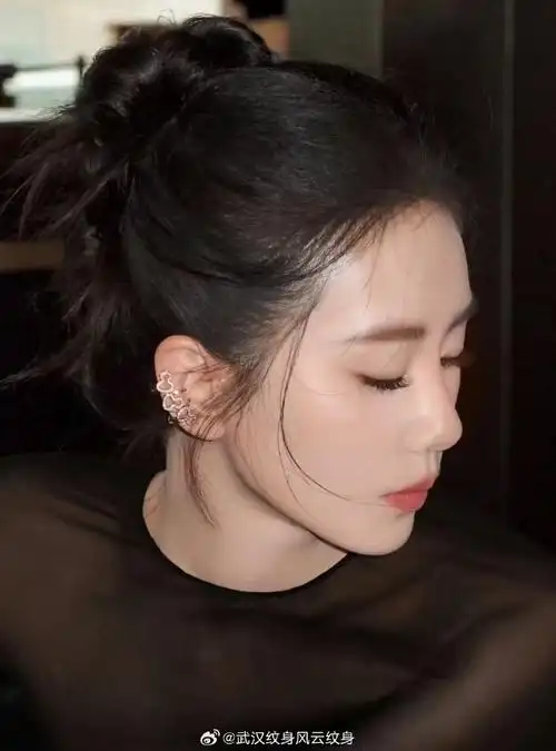 你们总是问我发际线各种对比图