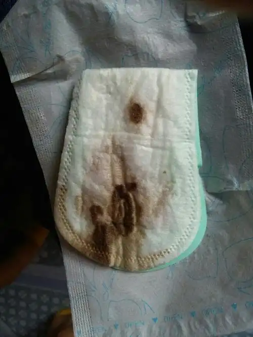 你好 我怀孕五个月7月14号我发现流有褐色血,拿这个姨妈巾流有褐色的