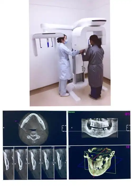 口腔cbct