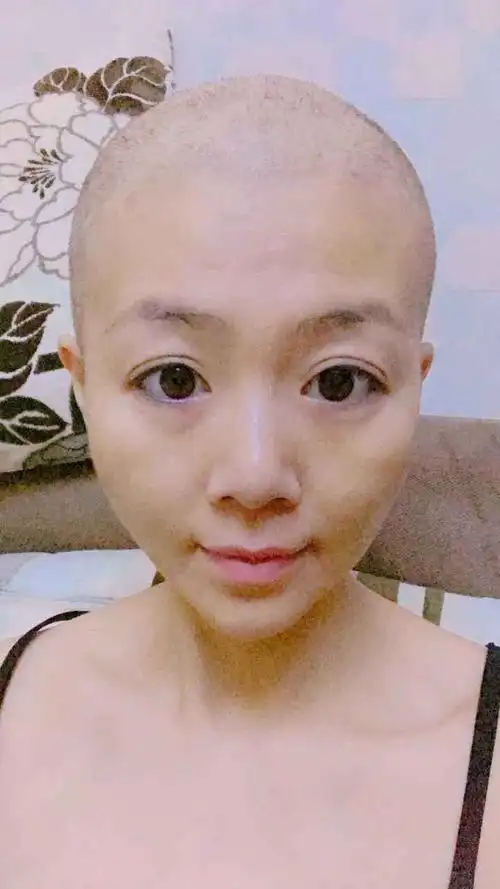 女生剃光头多久能长到齐肩短发?剃光头多久能长出来齐肩短发?