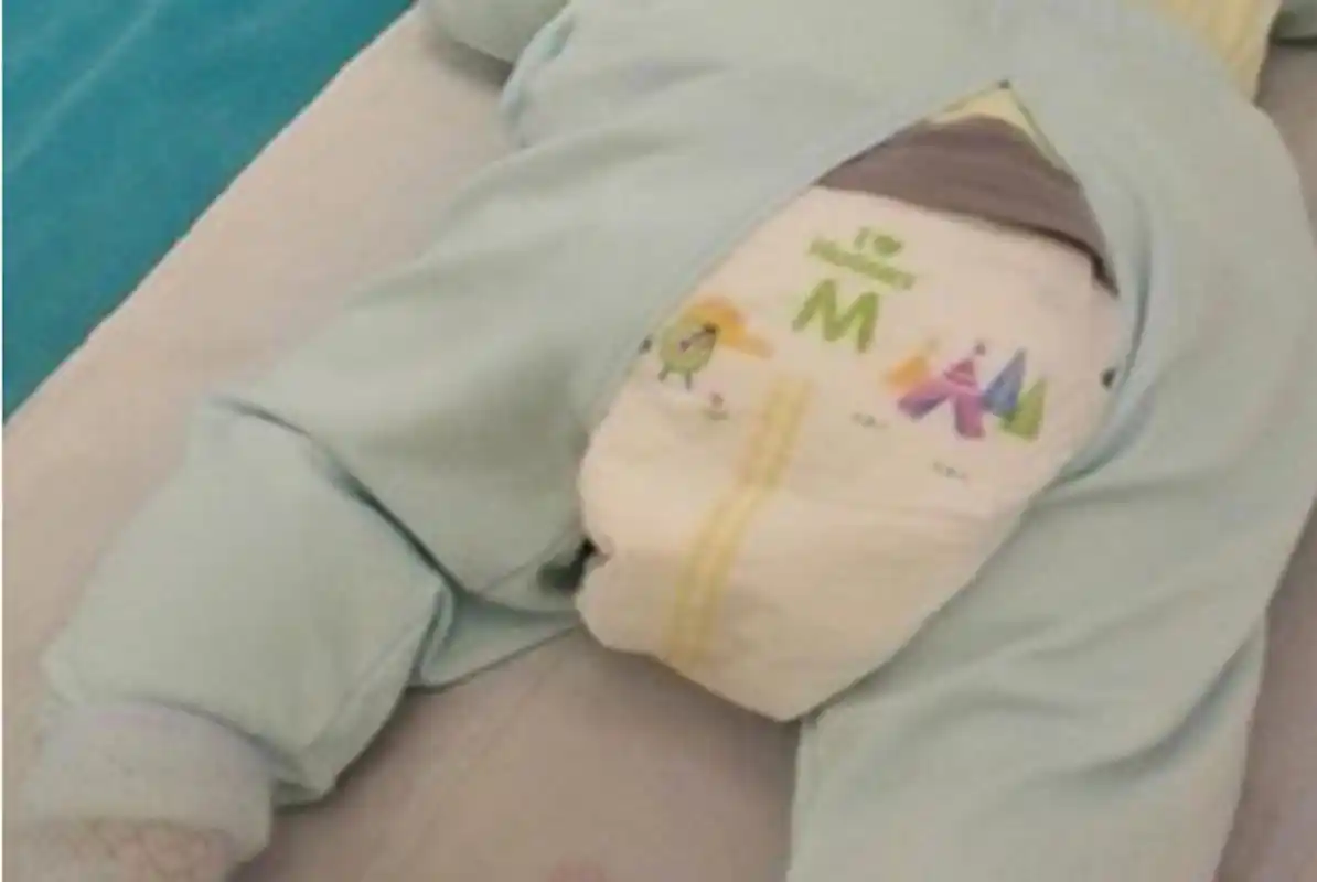 原创宝宝穿纸尿裤会导致o型腿?纸尿裤:这锅我不背,我要辟谣