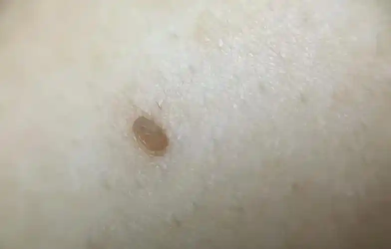 能直接用手揪掉吗?看完要记牢