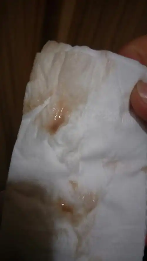 口碑!明明有例假的感觉就是不来是怎么回事"释疑解惑"-空竹博客