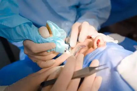 用于矫正眼睑的缺陷,畸形和缺陷的整形手术;以及美容修饰面部的眼部