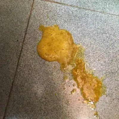 一个月大的宝宝拉便便是有泡泡,怎麼办.