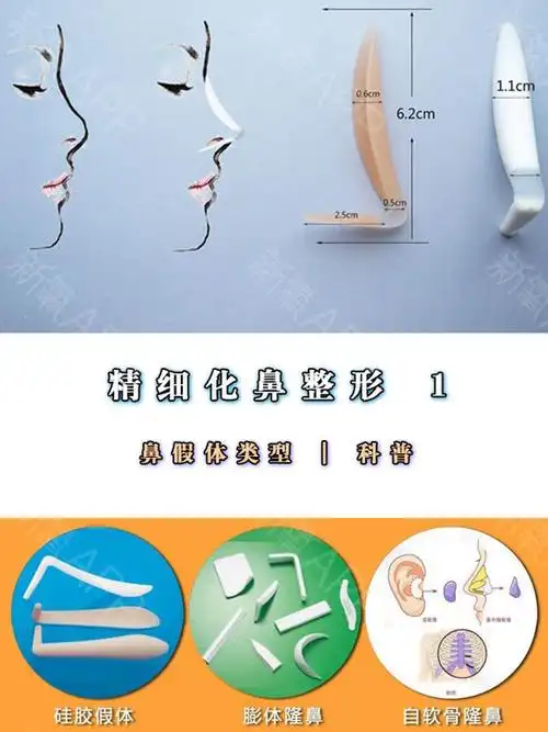 精细化鼻整形【1】鼻假体类型|科普(一)固体硅胶鼻_圈子-新氧美容整形