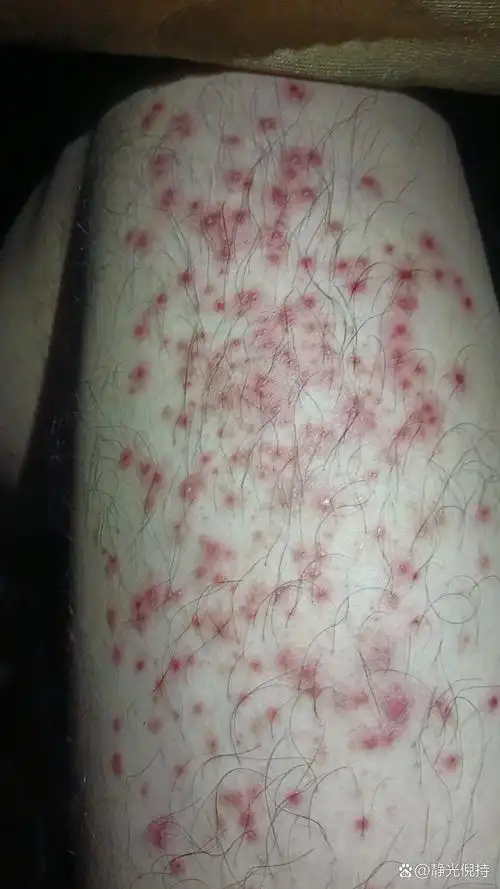 远离艾滋.远离不洁性生活.