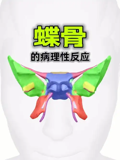 蝶骨引起的视觉面部问题你知道吗