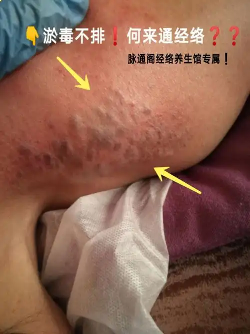 肩颈堵塞会引发130多种疾病,赶快打通肩颈吧 - 美篇