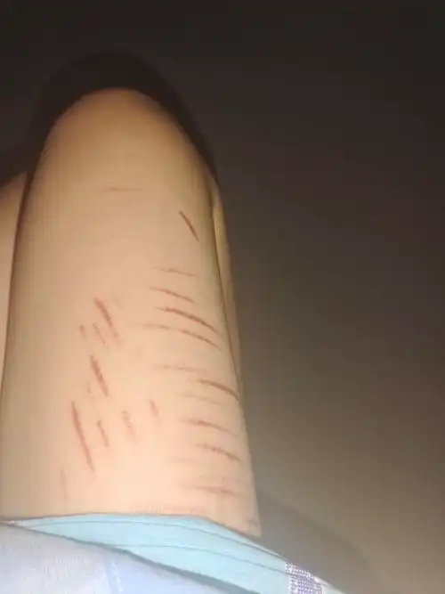 女孩子腿上有疤想纹身好看的纹身图片有没有