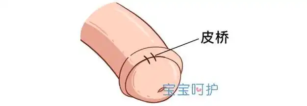 医生:这件事没做好,还得「割」一次|手术|出血|包茎_网易订阅
