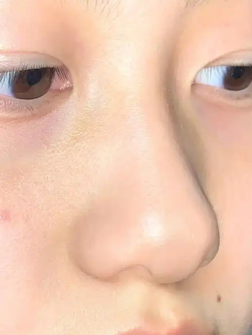 拔萝卜组合拔黑头真上头啊啊啊