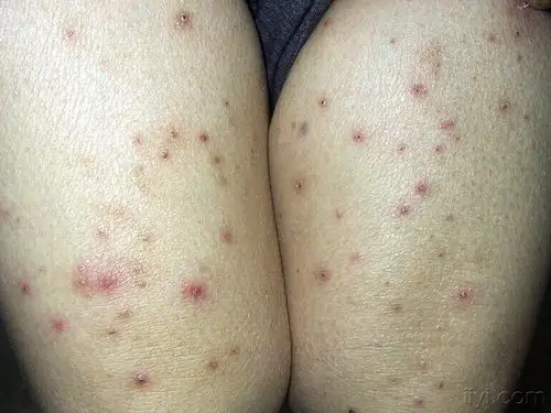 看图说病自己最近的病人