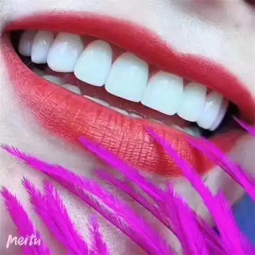 2021河间激光美白牙齿技术费用终身免费进修