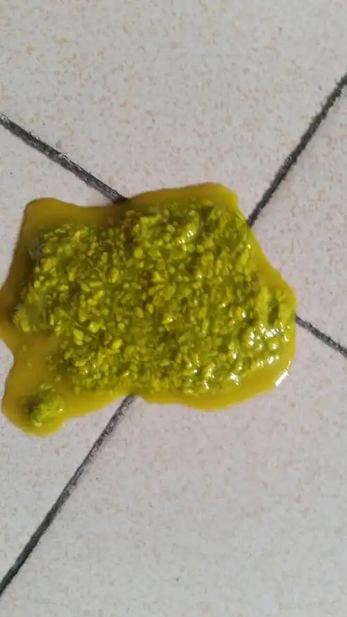 宝宝这段时间老拉绿黄的粑粑怎么改善?有图