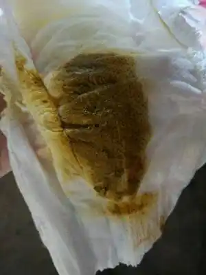 之前是金黄色,慢慢就变成这个颜色,由於黄疸这几天在吃茵栀黄胶囊和