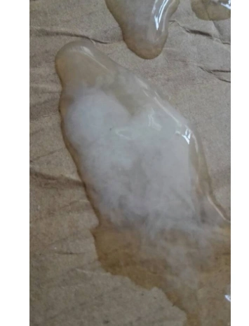 死精的症状图片54