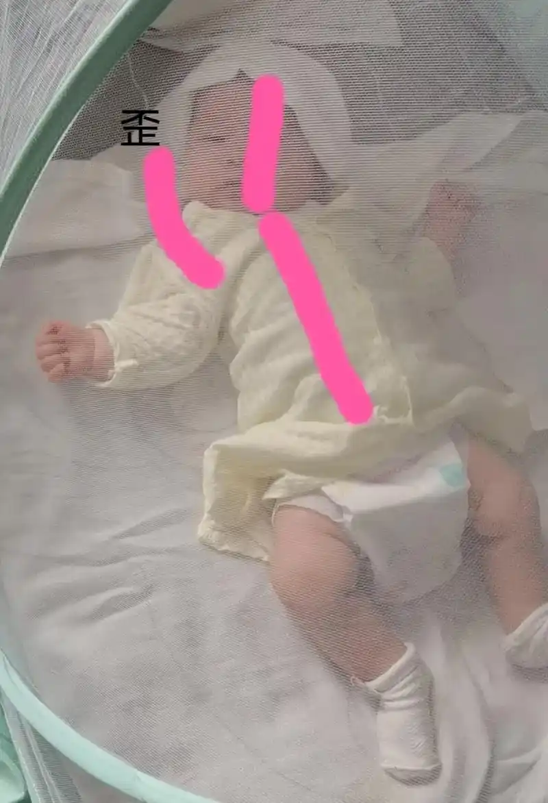 小孩歪头是什么?