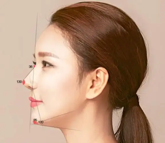 侧面 侧面照片来看,山根高度不够高,且鼻尖表现点不足的问题明显,鼻孔