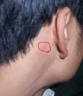 请点击输入图片描述8,颈窝颈窝也是天突穴所在的位置,颈部常裸露于外