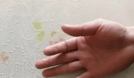 50岁左右的中老年人,手指僵硬,疼痛,怕冷,变形,预示||