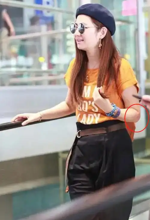 38岁任家萱露面,身材臃肿伤疤明显,拍戏被毁容后曾被老公说恶心_生活