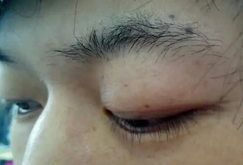 【图】面相里男左眉尾的痣代表什么