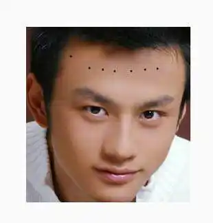 3, 印堂有痣:主贵 印堂有痣,男人主富裕,女人主贵气.