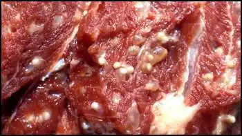 吃了块五成熟牛排,5个月后排出5米长牛带绦虫