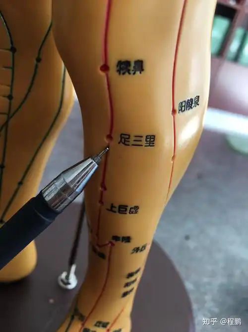 拔罐调理胃脘痛