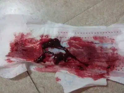 4月8号来月经一直有月经前胸胀痛的前兆本月排卵期同