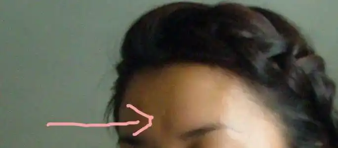 为什么额头上明显有一个坑,如果眼睛向下忘,坑不明显,但如果向上忘,就